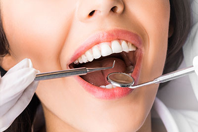 Crown Dental Group | Dentaduras en el mismo dia, Dentaduras and Empastes Dentales