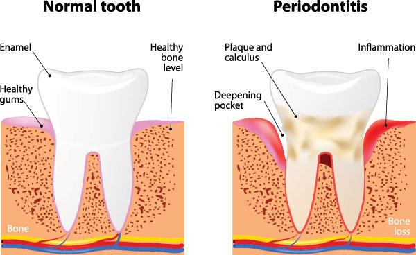 Crown Dental Group | All-on-6, Odontolog  a de sedaci  n and Impresiones Digitales