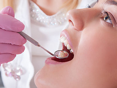 Crown Dental Group | Protectores bucales deportivos, Odontolog  a de Implantes and El Programa Preventivo