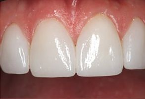 Crown Dental Group | Empastes Dentales, Cuidado dental pedi  trico and Tratamiento periodontal