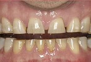 Crown Dental Group | Protectores bucales deportivos, Empastes Dentales and Reparaciones el mismo d  a